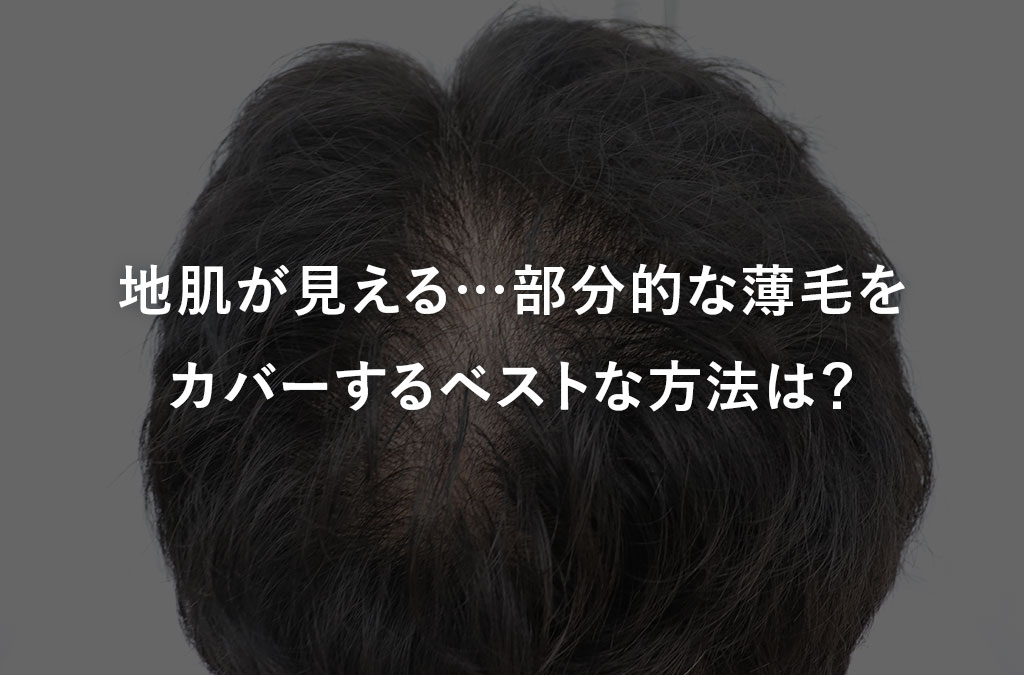 【毛髪診断士監修】地肌が見える…部分的な薄毛をカバーするベストな方法は？