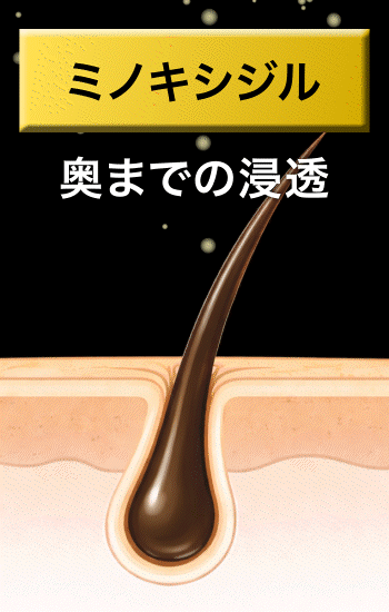 ミノキシジル