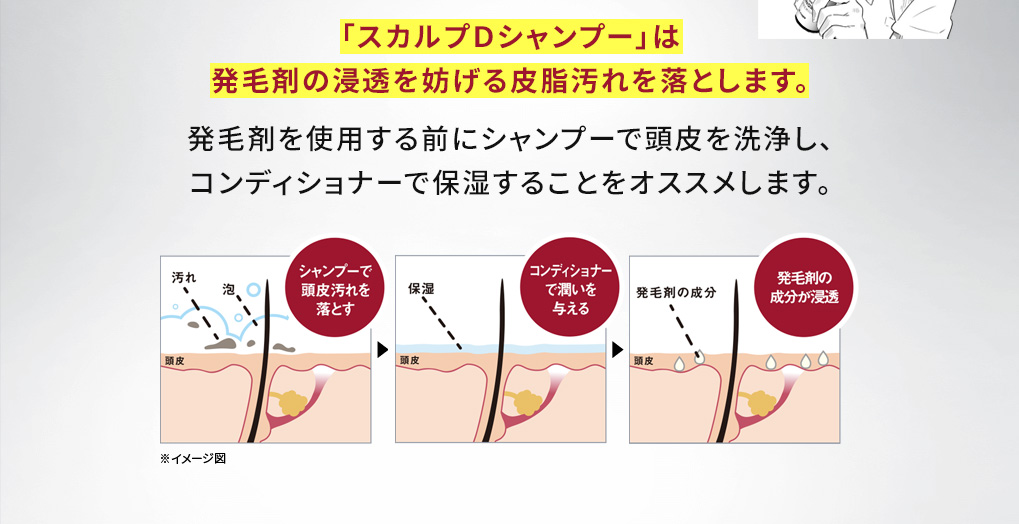 「スカルプＤシャンプー」は発毛剤の浸透を妨げる皮脂汚れを落とします。発毛剤を使用する前にシャンプーで頭皮を洗浄し、コンディショナーで保湿することをオススメします。