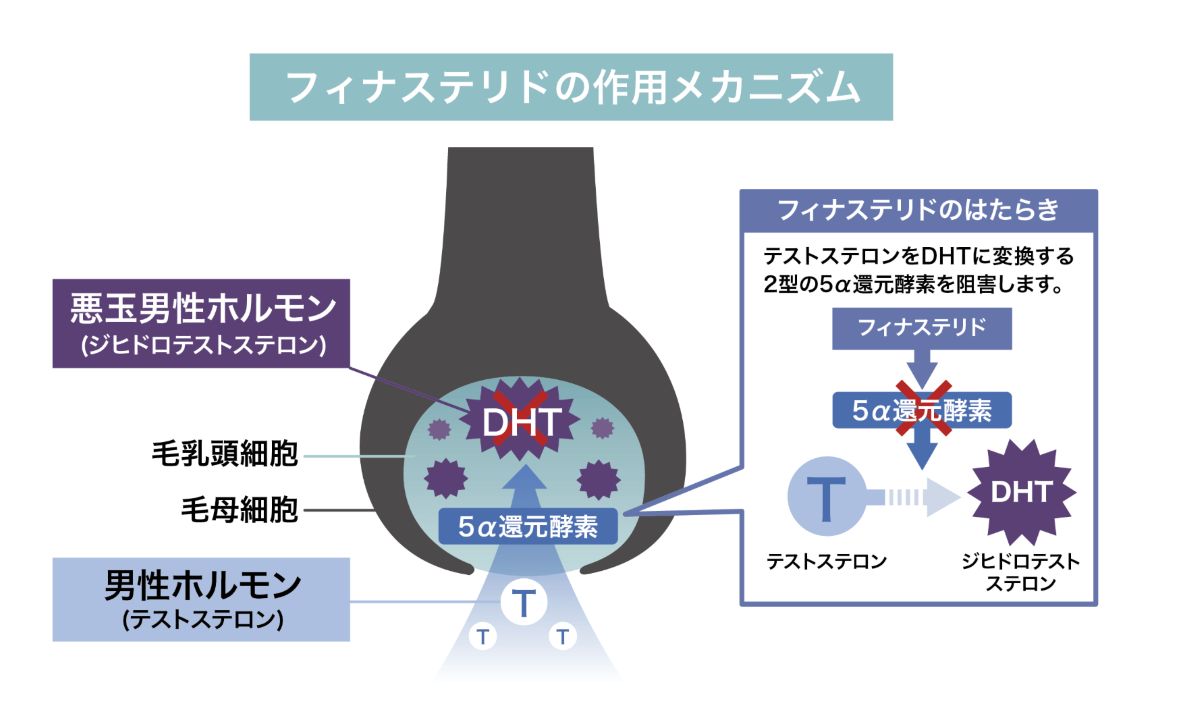 フィナステリドの効果とメカニズム