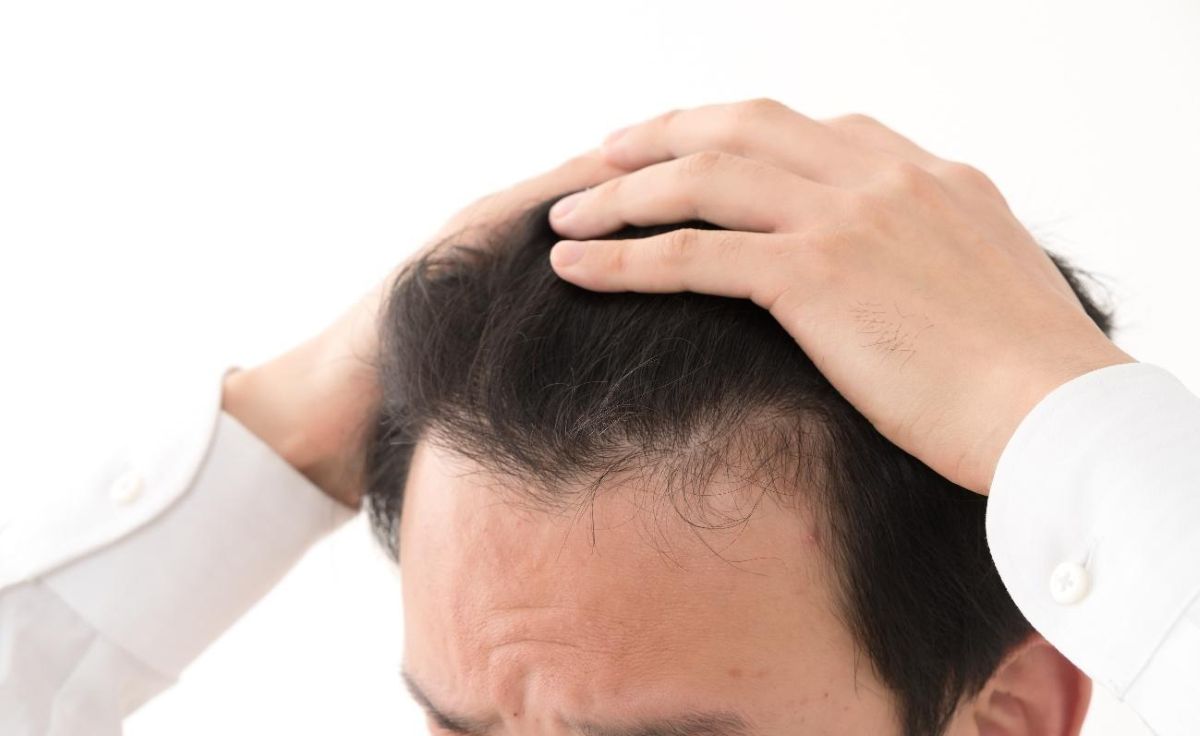 フィンペシアの効果｜期待できる発毛・育毛作用