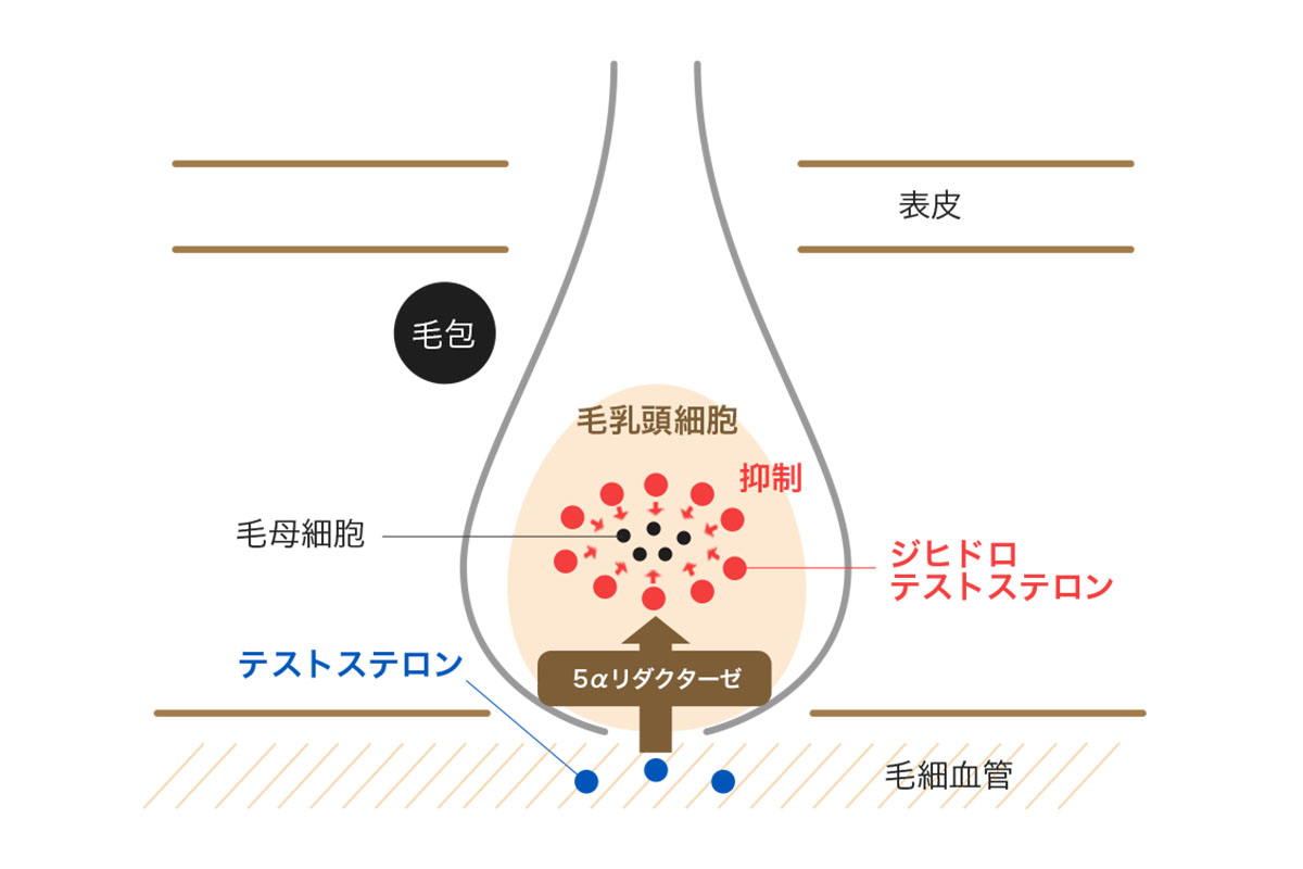 ザガーロのAGAへの効果とメカニズム