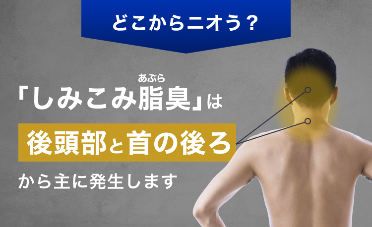 どこからニオう？｜「しみこみ脂（あぶら）臭」は後頭部と首の後ろから主に発生します
