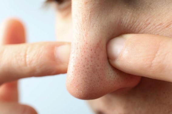 男性の鼻の黒ずみの原因とは？
