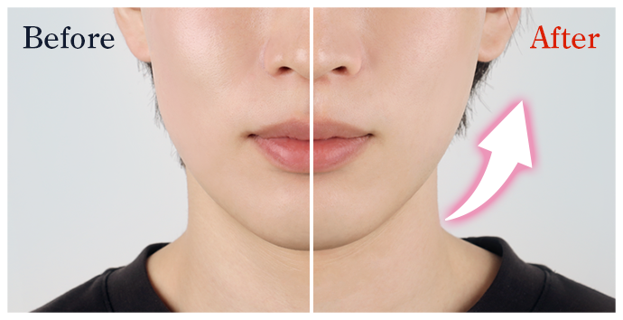 Before After