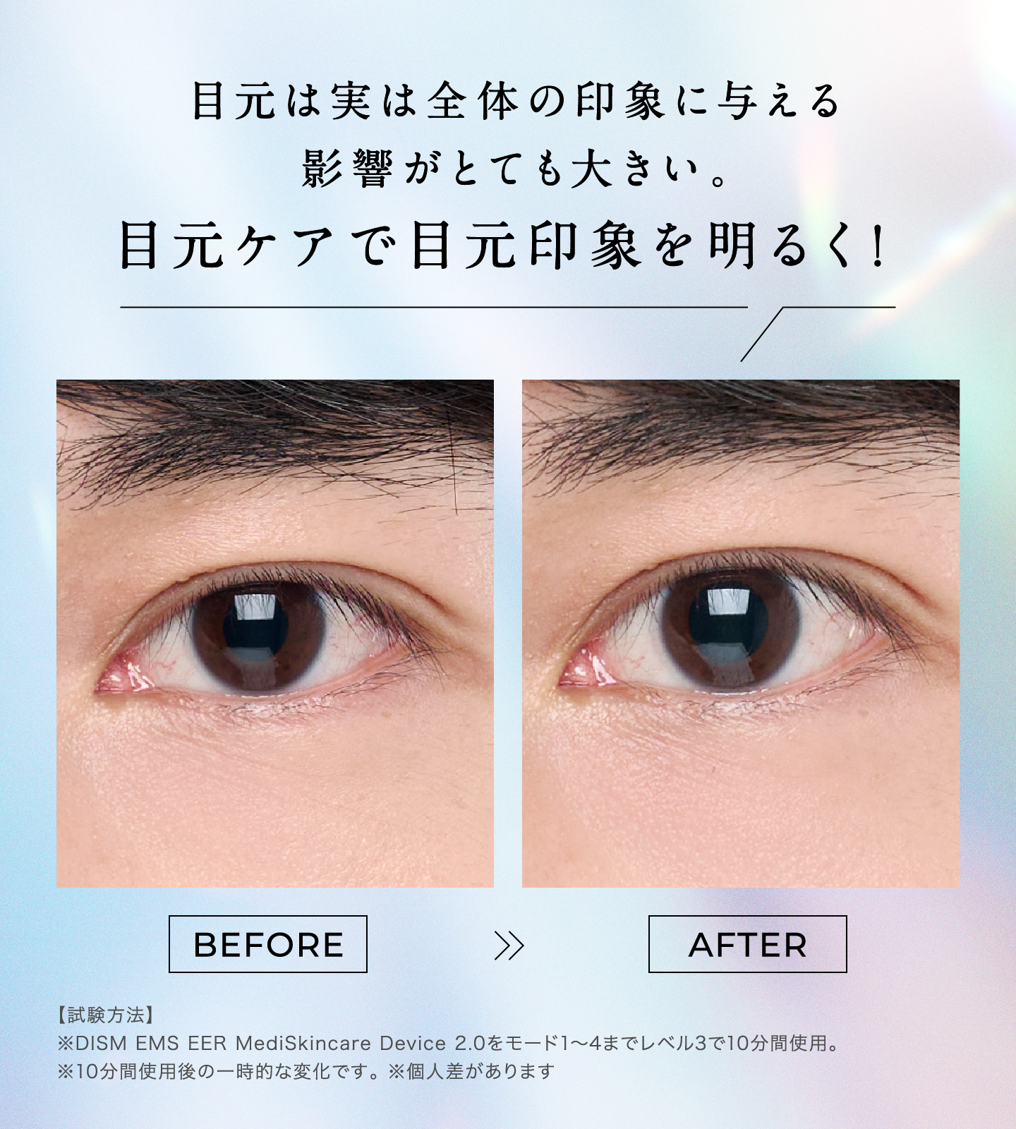 目元は実は全体の印象に与える影響がとても大きい。目元ケアで目元印象を明るく！ BEFORE ≫ AFTER 【試験方法】※DISM EMS EER MediSkincare Device 2.0をモード1〜4までレベル3で10分間使用。※10分間使用後の一時的な変化です。※個人差があります