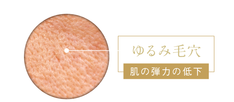 ゆるみ毛穴 肌の弾力の低下