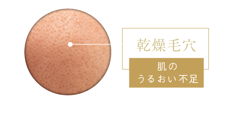 乾燥毛穴 肌のうるおい不足