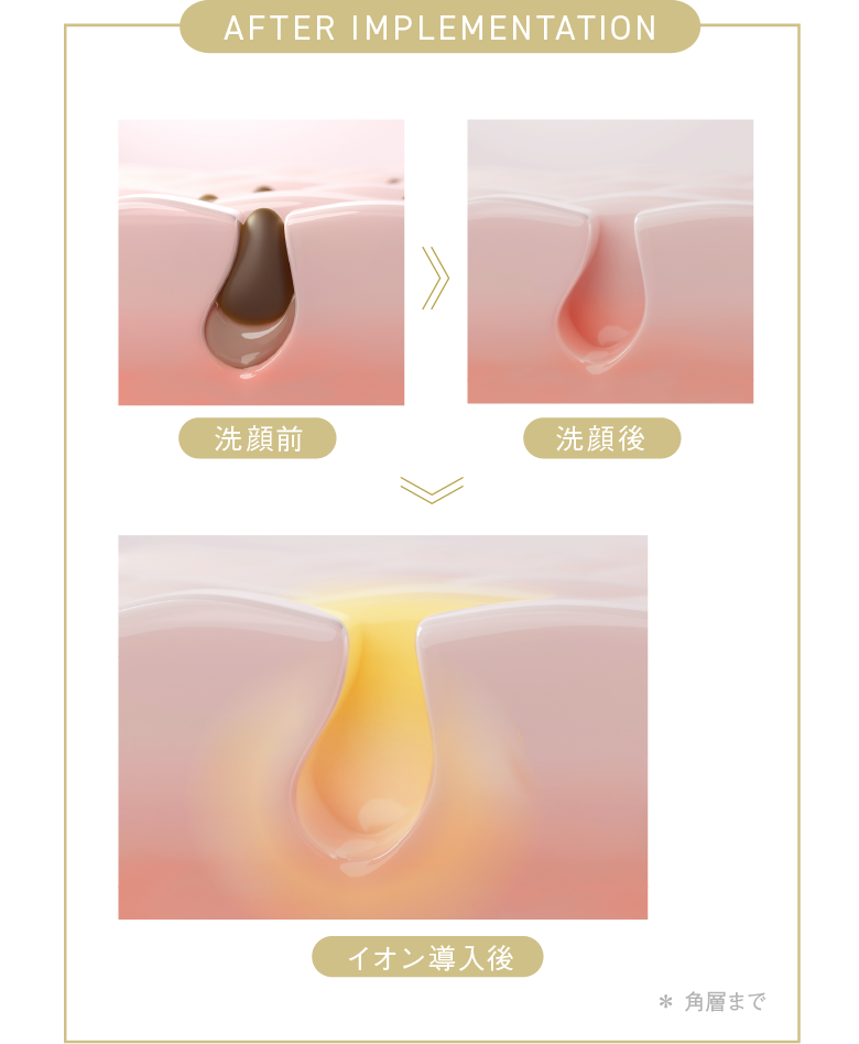 DISM EMS ポアディープクリア＆リフトブラシ