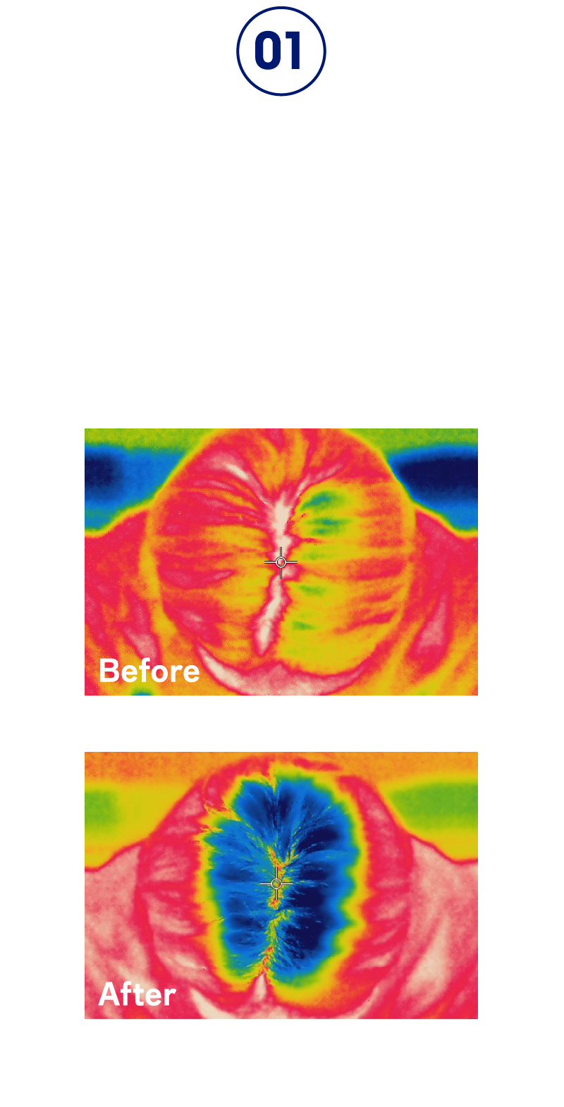 ※1BeforeAfter 