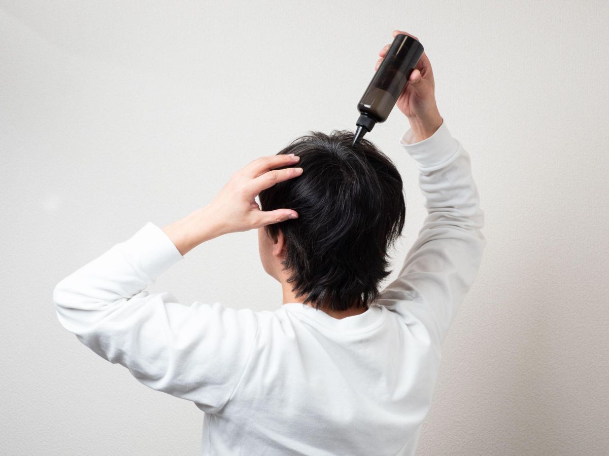 ミノキシジルとは