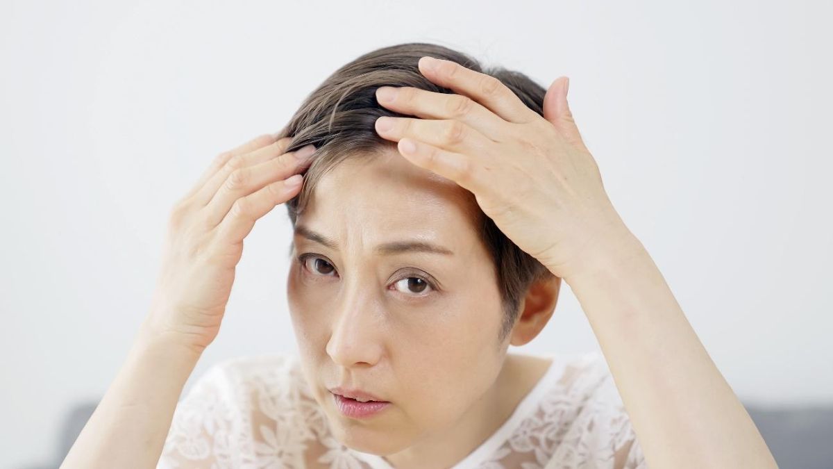 女性がミノキシジルを使用する際の注意点は？効果や副作用まで解説