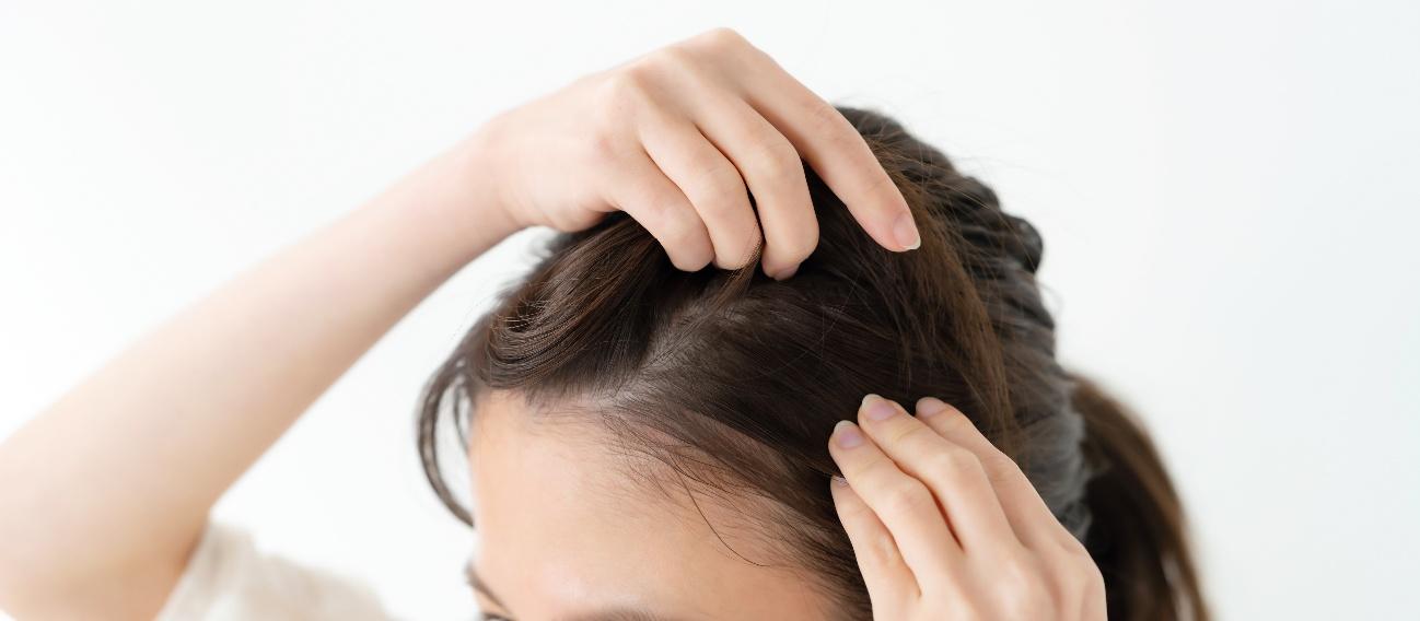 女性の壮年性脱毛症（FAGA）とは