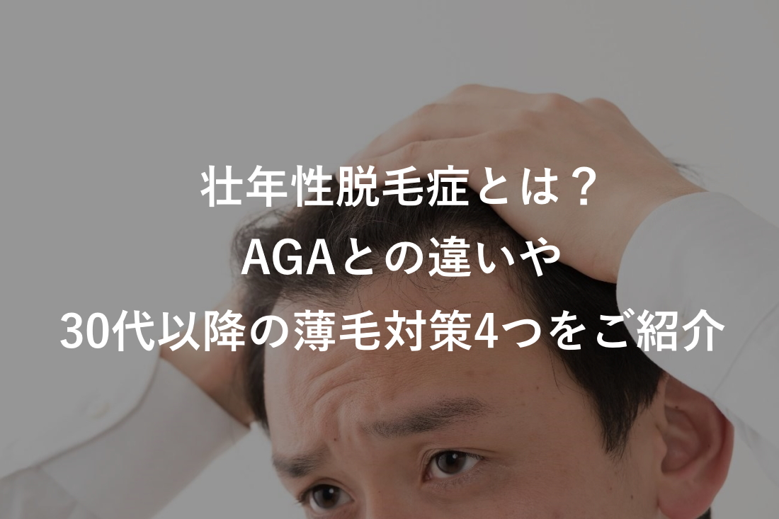 【毛髪診断士監修】AGAと壮年性脱毛症に違いはあるのか？30代以降の薄毛対策5つのポイント