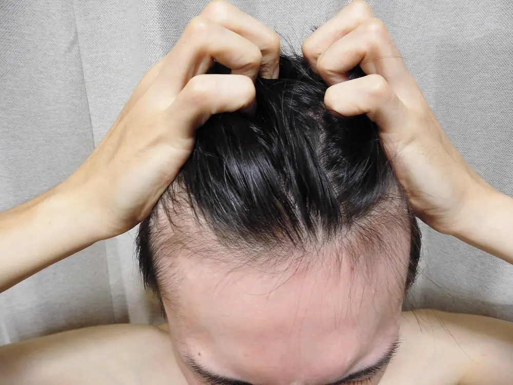 髪の毛がガタガタしている…の悩みに！ガタつく原因と直毛にする方法
