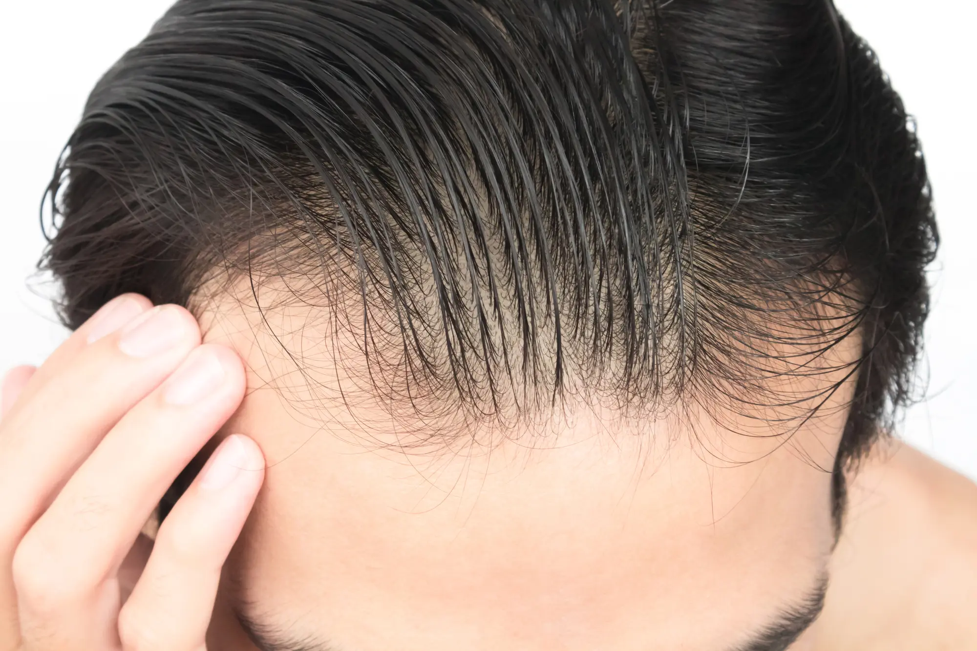 【毛髪診断士監修】髪がパサパサな男は薄毛（ハゲ）になりやすい　夏と冬に要注意