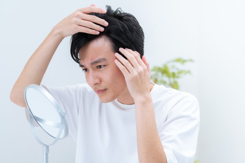>薄毛の悩みは若者でも始まっている
