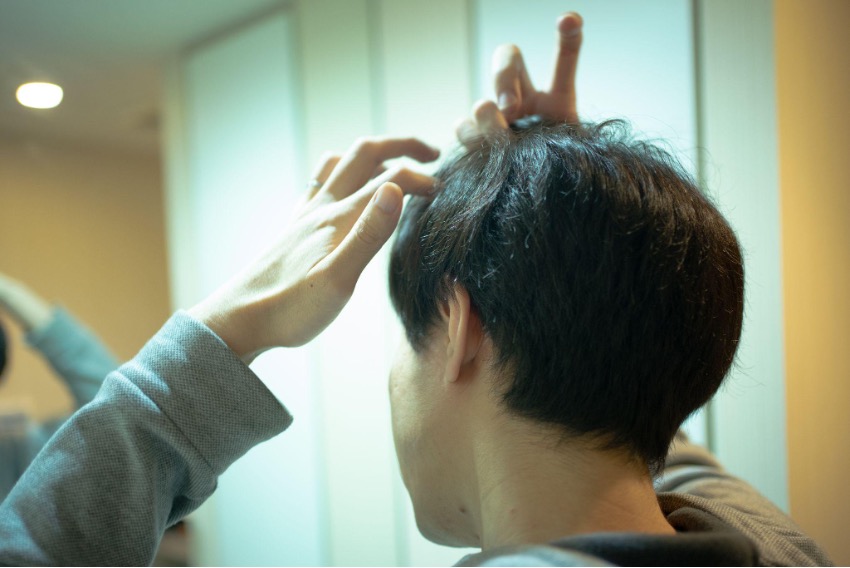 ミノキシジル・フィナステリドの初期脱毛はやばいって本当？！原因から脱毛期間まで詳しく解説