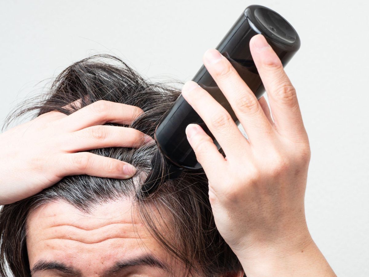 ミノキシジルによる発毛メカニズム