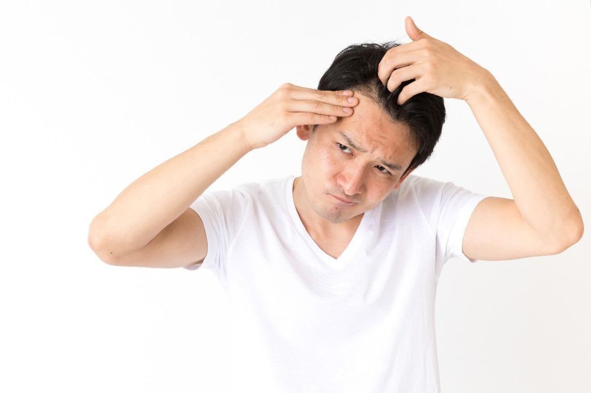 ミノキシジルをやめるとどうなる？