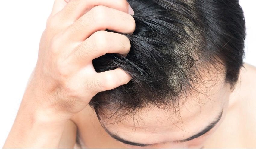 発毛剤と育毛剤の副作用