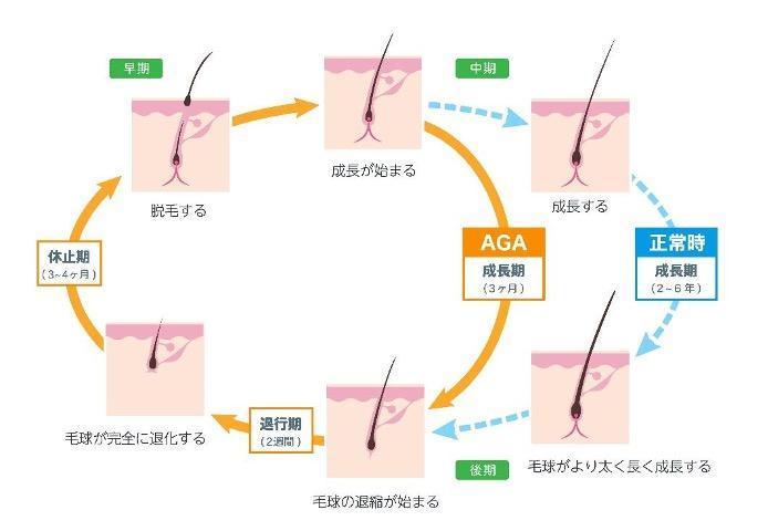 ミノキシジルの発毛メカニズム