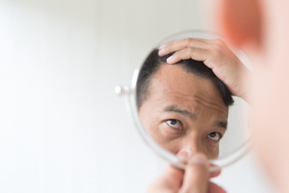紫外線は抜け毛の間接的な原因