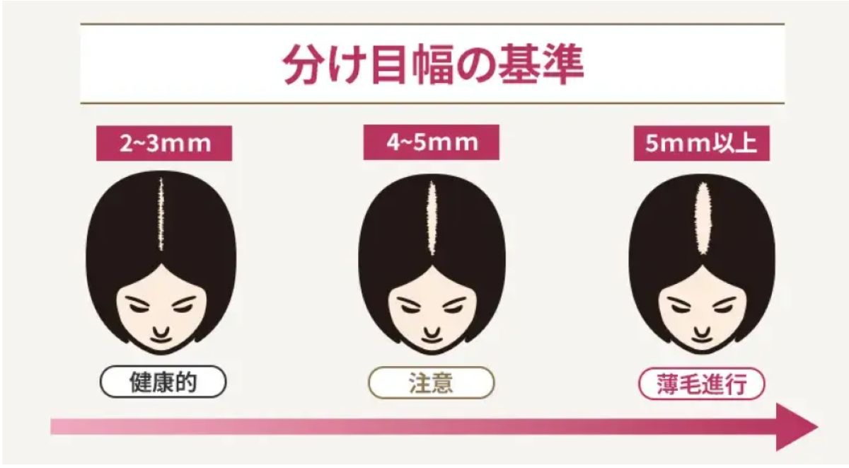 分け目幅の基準