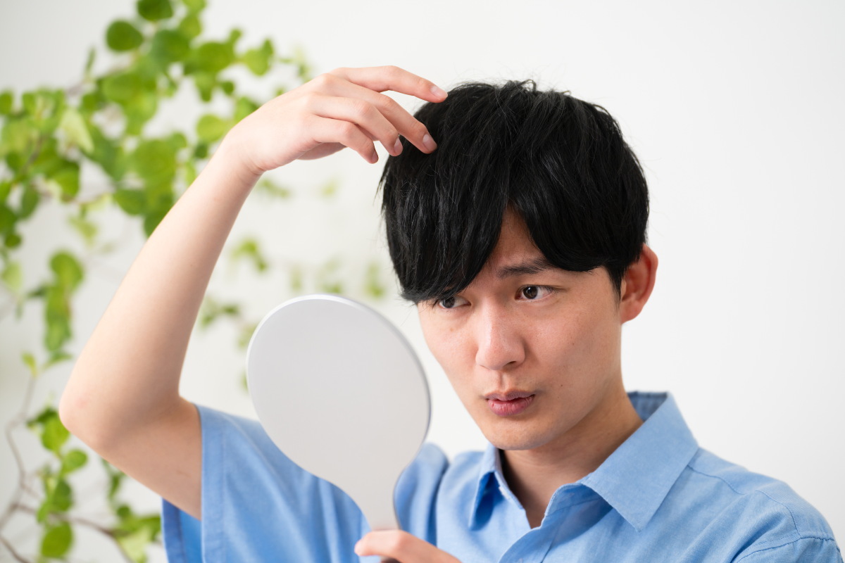 20代でハゲる人は意外と多い？若年性脱毛症の実態