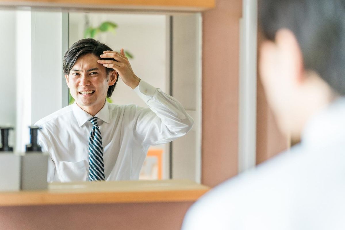 前髪はげの原因と前兆は？男性女性別の判断基準とセルフチェック方法