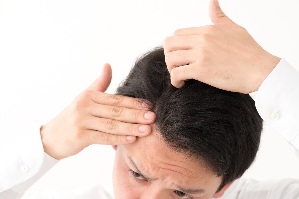 前髪がスカスカになる原因とは？対策やAGAとの違いを解説！