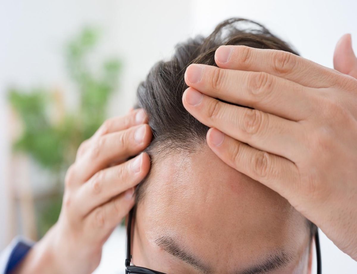 前髪がスカスカになるのはなぜ？