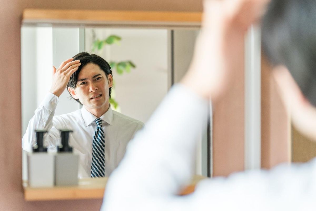 前頭部の薄毛の原因と判断方法！AGAの特徴を解説