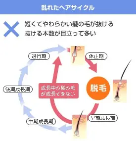 なぜ短い抜け毛はAGAの可能性があるのか？