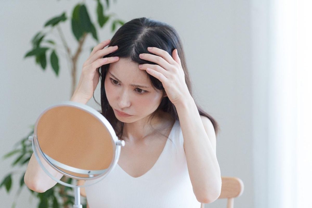 女性の薄毛とは？男性との違い